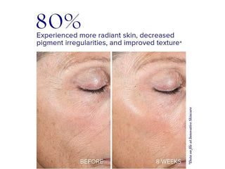Active Peel System