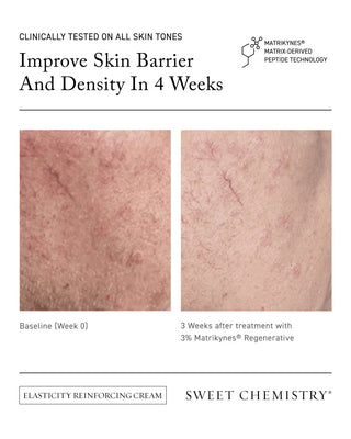 Barrier Repairing Hydra-Serum