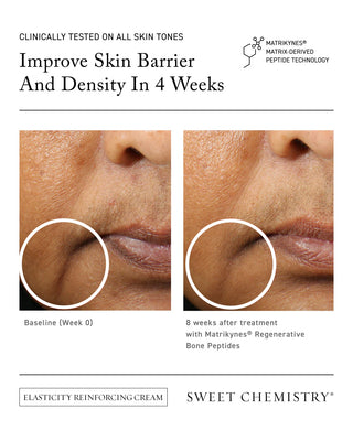 Elasticity Reinforcing Lipid-Cream