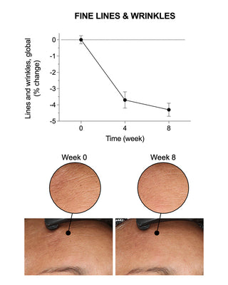 Elasticity Reinforcing Lipid-Cream